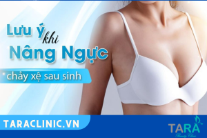 Nâng ngực chảy xệ sau sinh giá bao nhiêu?