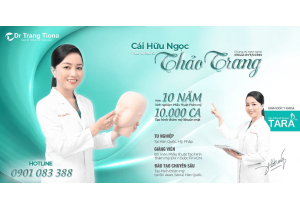 Nâng mũi sụn Softxil