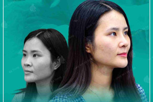 Sở hữu 6 dáng mũi xấu này bạn cần sửa ngay để đổi vận