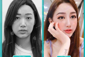 Sự thật về 5 tướng mũi giàu giúp bạn thành công?