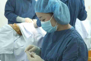 Tìm hiểu 8 loại sụn nâng mũi tốt hiện nay