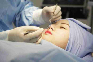 Cắt chỉ sau nâng mũi có đau không? Có nên tự cắt chỉ?