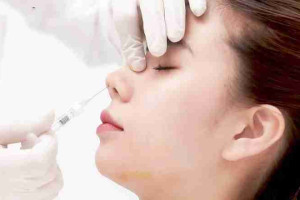 Có nên nâng mũi không phẫu thuật? Hiệu quả ra sao?