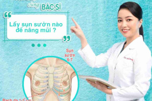 Sụn sườn được lấy từ đâu để nâng mũi?