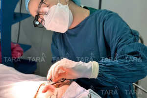 Review nâng mũi bác sĩ Trang: Đẹp và chất lượng