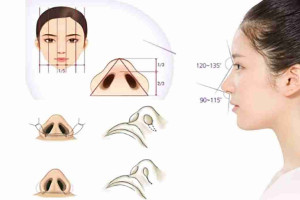 Bác sĩ giải đáp: Cắt cánh mũi có để lại sẹo xấu không?