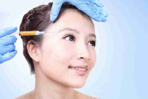 Bác sĩ giải đáp: Cấy mỡ mặt tự thân xong cần kiêng gì?