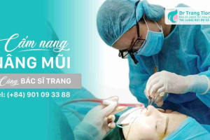 Đâu là phương pháp nâng mũi hiện đại nhất hiện nay?