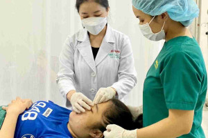 Nâng mũi cắt chỉ sớm có sao không?