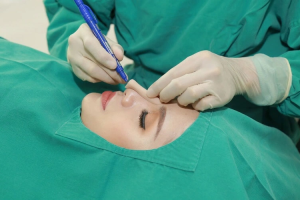 Bác sĩ giải đáp: Nâng mũi sụn silicon giá bao nhiêu?