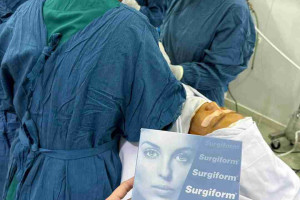 Bác sĩ giải đáp: Nâng mũi Surgiform giữ được bao lâu?