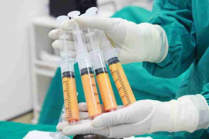Cấy mỡ mặt khi mới tiêm filler có sao không?