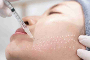 Cẩm nang hữu ích tiêm căng bóng da mà bạn cần biết