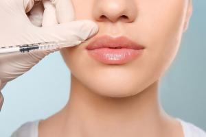 Bác sĩ giải đáp: Tiêm filler môi để được bao lâu?