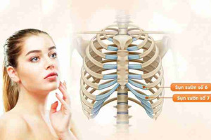 Lấy sụn sườn của người khác để nâng mũi được không?