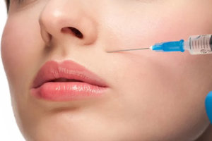 Những điều chưa biết về tiêm filler rãnh cười
