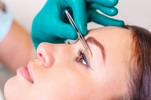 Sự thật về cắt mí mắt không đau và lưu ý quan trọng