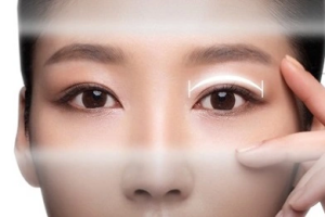Mí sụp, nên nâng cung chân mày hay cắt mí thì tốt nhất?