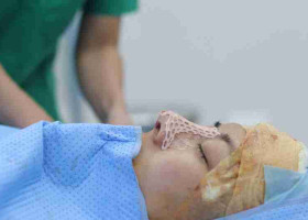 Sửa mũi hỏng nhiều lần có nguy hiểm không?