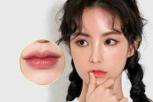 Tiêm filler môi có nên không? Giá bao nhiêu?