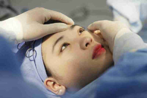 Cắt mí mở góc mắt ở đâu thì đẹp?