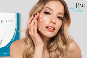 Radiesse – chất làm đầy giúp trẻ hóa từ bên trong