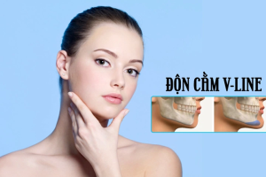 Hướng dẫn vệ sinh tại nhà sau khi độn cằm đúng cách