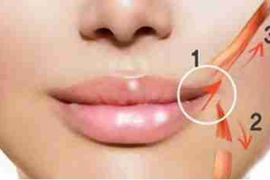 Hướng dẫn vệ sinh sau khi tạo hình môi cười
