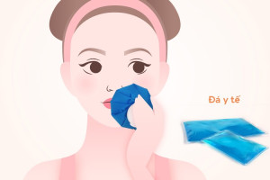 Cách giảm sưng sau khi cấy mỡ trẻ hóa da?