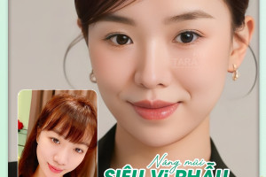 Sự thật về nâng mũi không đau tại TARA Beauty Clinic