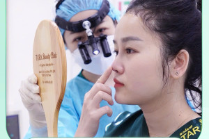 Review chi tiết nâng mũi không đau tại Sài Gòn