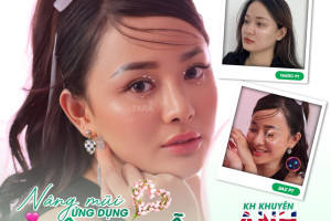 Vì sao nên đến TARA để nâng mũi siêu vi phẫu?