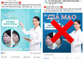 Cảnh báo giả mạo TS.BS Trang về nâng mũi siêu vi phẫu