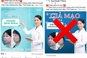 Cảnh báo giả mạo TS.BS Trang về nâng mũi siêu vi phẫu