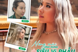Lựa chọn Nâng mũi siêu vi phẫu và Các phương pháp Nâng mũi khác?