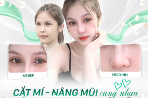 Nâng mũi và cắt mí mắt: Combo hoàn hảo kiến tạo nhan sắc vàng