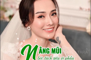 Nâng mũi siêu vi phẫu khắc phục mũi gồ để cao, đẹp hơn