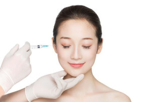 Top 3 nhóm địa chỉ tiêm filler an toàn tại TP.HCM (kèm tiêu chí chọn)