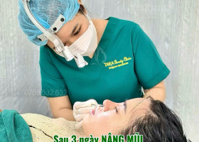 Toàn tập về nâng mũi (A-Z): So sánh các phương pháp và tại sao Siêu Vi Phẫu là xu hướng 2026