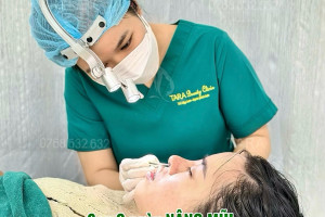 Toàn tập về nâng mũi (A-Z): So sánh các phương pháp và tại sao Siêu Vi Phẫu là xu hướng 2026