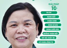 8 câu hỏi vàng giúp bạn chọn đúng dịch vụ Căng da Midface trẻ hoá hoàn hảo