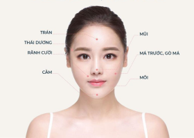 Nên cấy mỡ mặt hay tiêm filler fullface để kịp đẹp trước Tết?