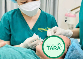 Tiêm fullface trước Tết: nên làm trước bao lâu để tự tin đi chơi?