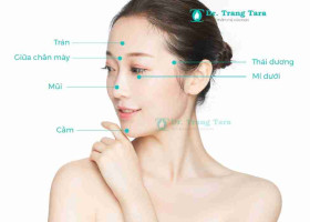 Tiêm fullface là gì? Giải pháp trẻ hóa và tạo hình gương mặt không phẫu thuật