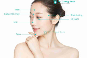 Tiêm fullface là gì? Giải pháp trẻ hóa và tạo hình gương mặt không phẫu thuật