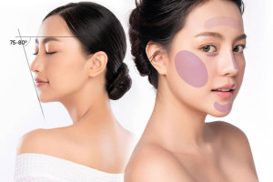 Tiêm fullface khác gì với việc chỉ tiêm từng vùng lẻ?