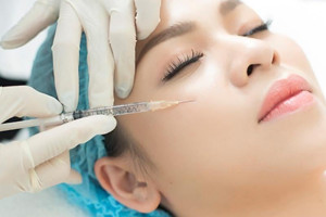 Cấy mỡ mặt vs filler: cái nào hợp với người trên 35 tuổi?