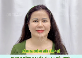 Review căng da mặt tại TARA Beauty TP.HCM: hành trình trẻ lại 10 tuổi của khách hàng