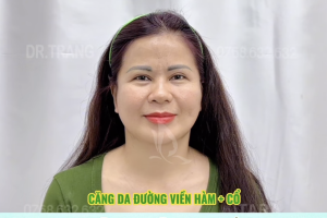 Review căng da mặt tại TARA Beauty TP.HCM: hành trình trẻ lại 10 tuổi của khách hàng