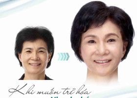 Căng da Midface giữ được bao lâu? Khuôn mặt trẻ ra khoảng bao nhiêu tuổi?